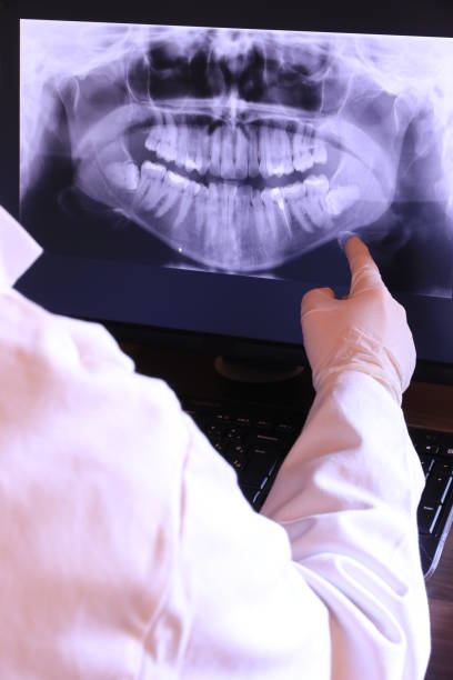 Best Emergency Root Canal Therapy in Tladega, AL