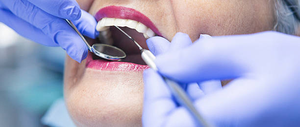 Best Walk-In Emergency Dental Services in Tladega, AL